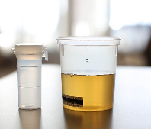urine test tips
